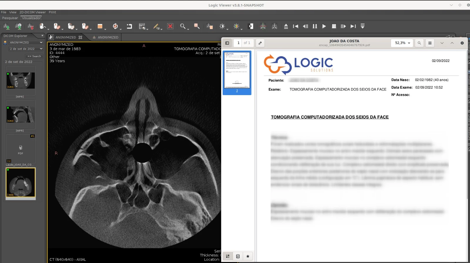 dicom4